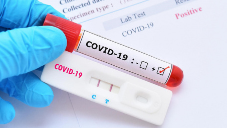 Mua dụng cụ test nhanh Covid-19: Cục Cạnh tranh lưu ý 4 điểm với người M.Cwin800.com thể thao, casino live, bắn cá và slot nổ hũ