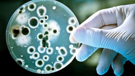 Developing gold nanoparticle-based biosensors for simple and fast detection of Staphylococcus aureus