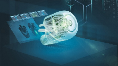 Đối phó với COVID -19, Tập đoàn Siemens tăng cường công nghệ thúc đẩy thiết kế, Nền tảng hàng đầu cung cấp Cwin com các thiết bị y tế