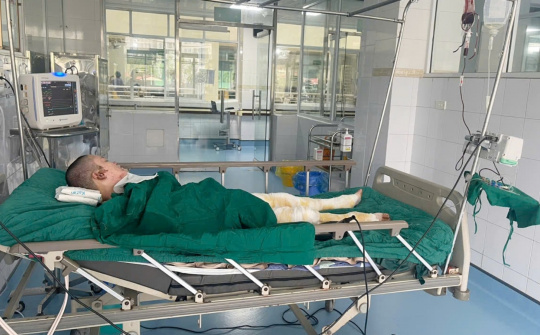 Công đoàn Tổng công ty Giấy kêu gọi quyên góp cho mẹ đơn thân bị bỏng nặng nguy kịch