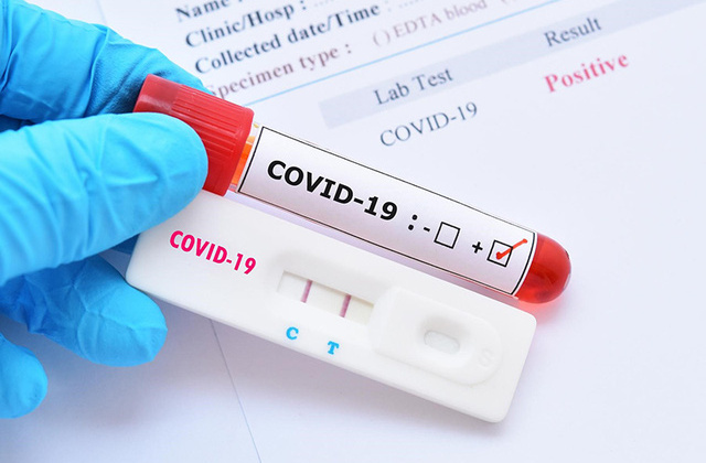 Mua dụng cụ test nhanh Covid-19: Cục Cạnh tranh lưu ý 4 điểm với người M.Cwin800.com thể thao, casino live, bắn cá và slot nổ hũ