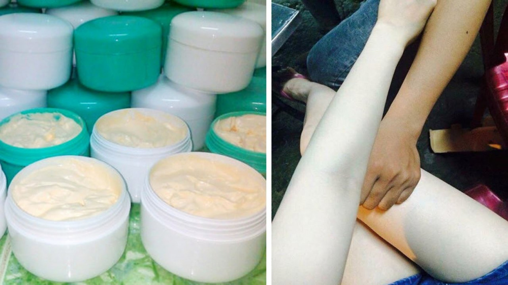 kem trắng da chứa corticoid