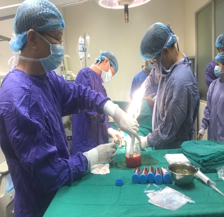 Nghiên cứu sử dụng tế bào gốc tự thân trong điều trị nhồi máu não