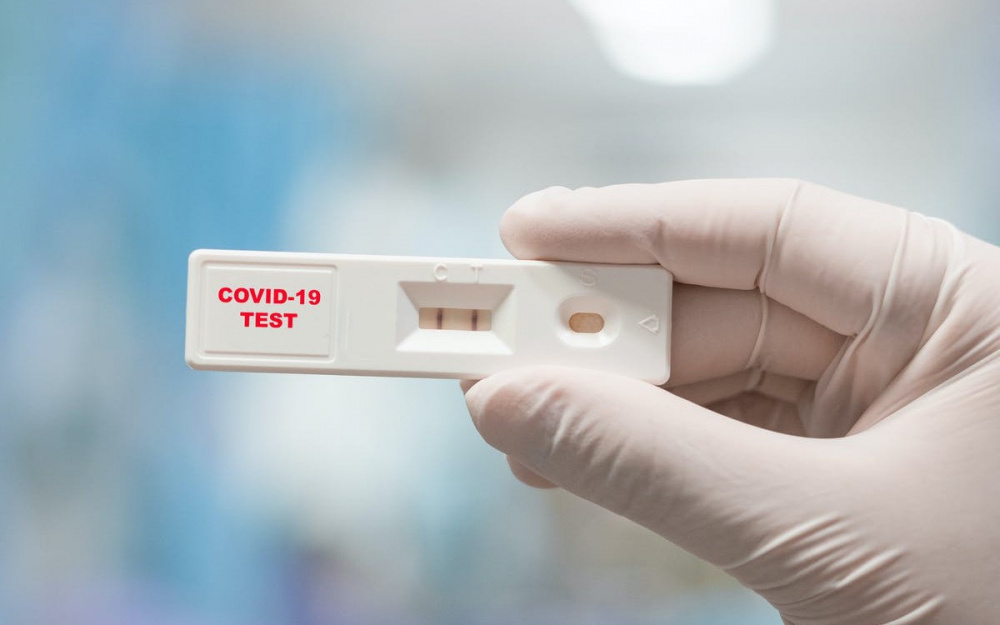 Kit test Covid-19 "loạn giá", Tổng cục Quản lý thị trường tăng cường kiểm tra, kiểm soát
