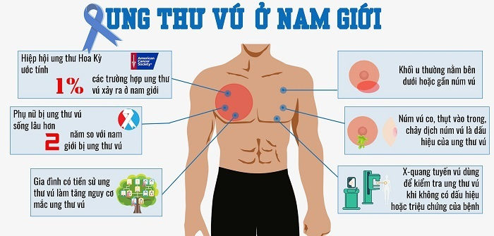 Ung thư vú ở nam giới