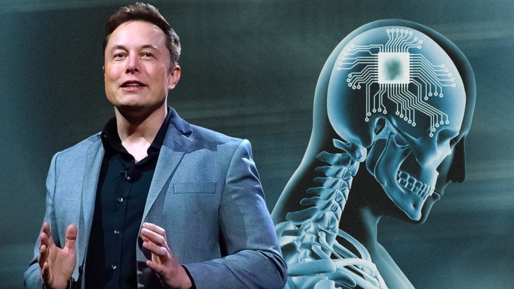 Elon Musk cho biết công ty của ông đã tiến hành cấy ghép chip lên não người và bệnh nhân đang hồi phục tốt. 
