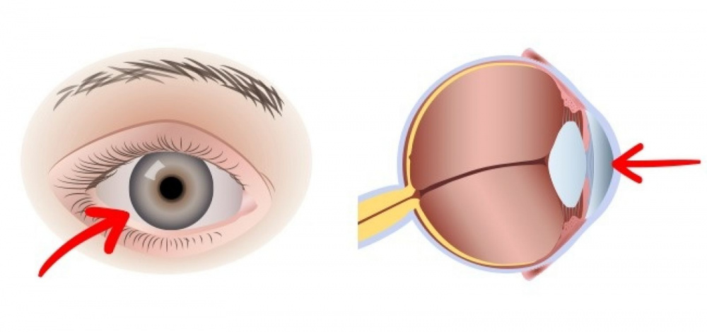 ăn trứng mỗi ngày rất tốt cho đôi mắt của bạn
